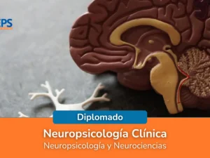 Neuropsicologi╠üa Cli╠ünica.webp