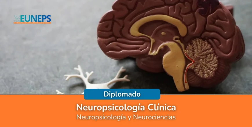 Neuropsicologi╠üa Cli╠ünica.webp
